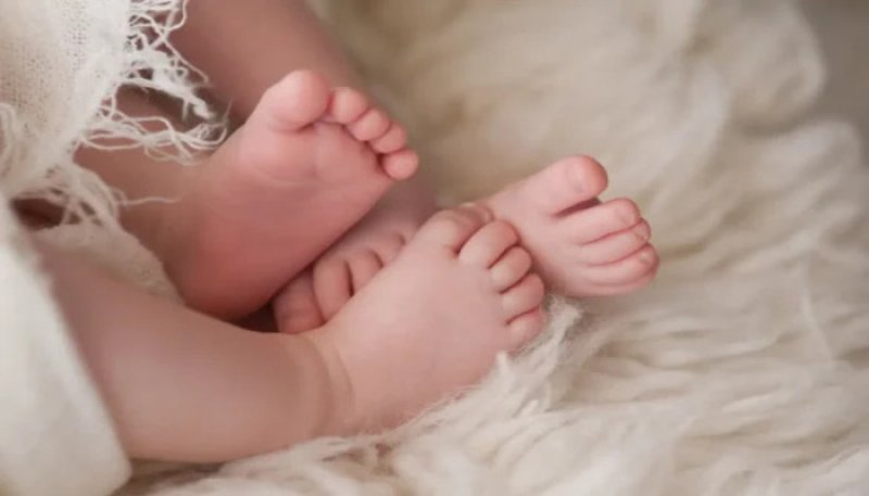 Conjoined twin girls born at Castle Street Hospital