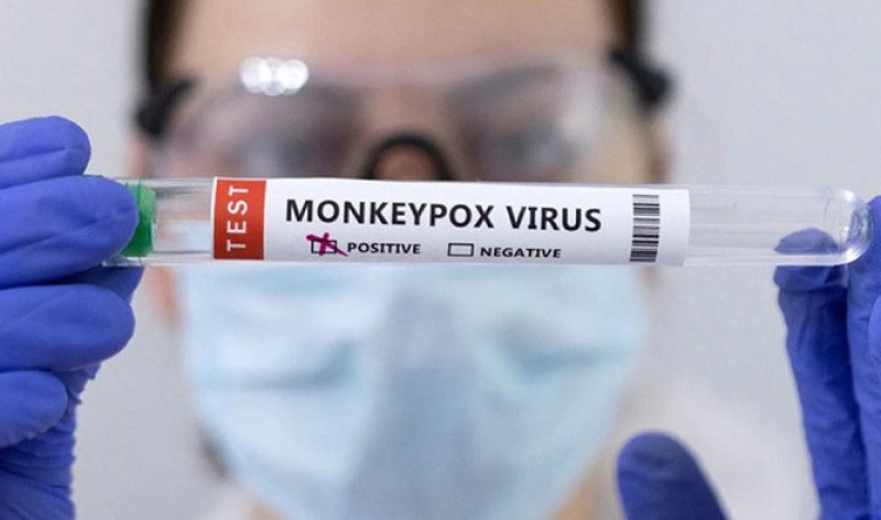 Pakistan Reports first M-Pox Case 