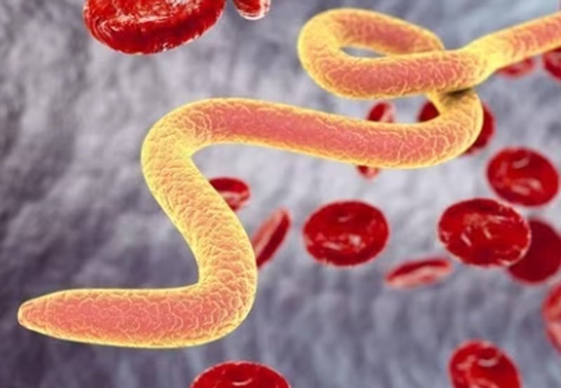 World's first case of parasitic worm found in woman's brain