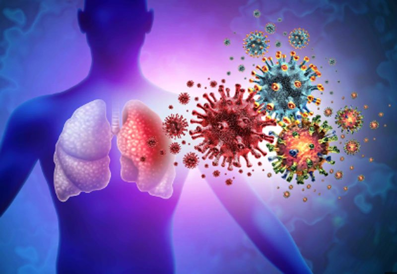 Sri Lanka reports uptick in respiratory cases 