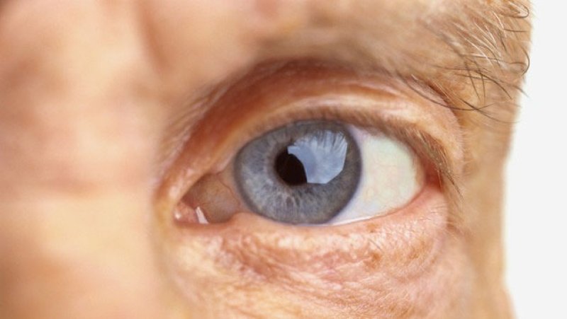 Diabetes poses growing threat to eye health in Sri Lanka