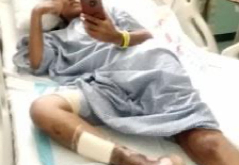 Sri Lankan housemaid endures horrific abuse in Saudi Arabia
