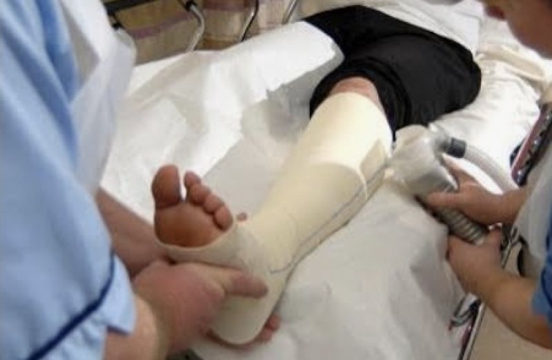 Injured patient claims plaster came off minutes
