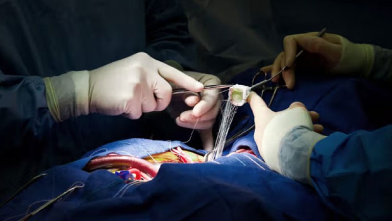 Nearly 5,000 patients await heart surgery at CNH