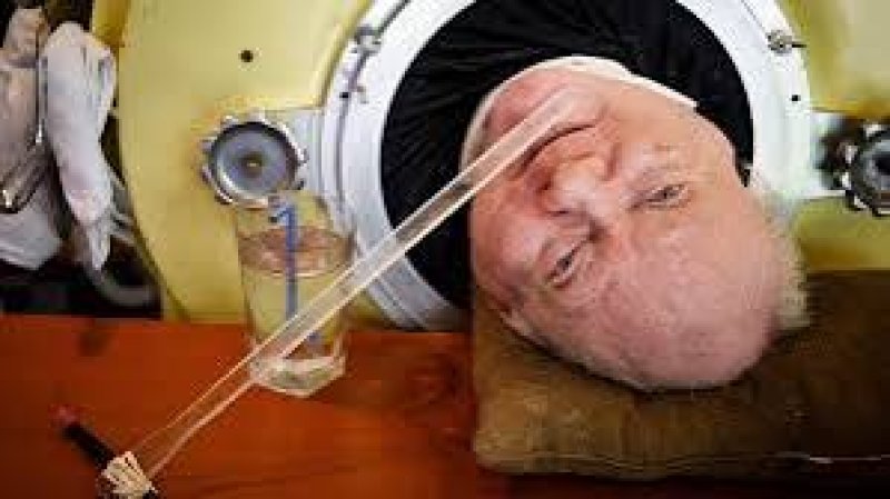 Man dies after living in iron lung for 70 years