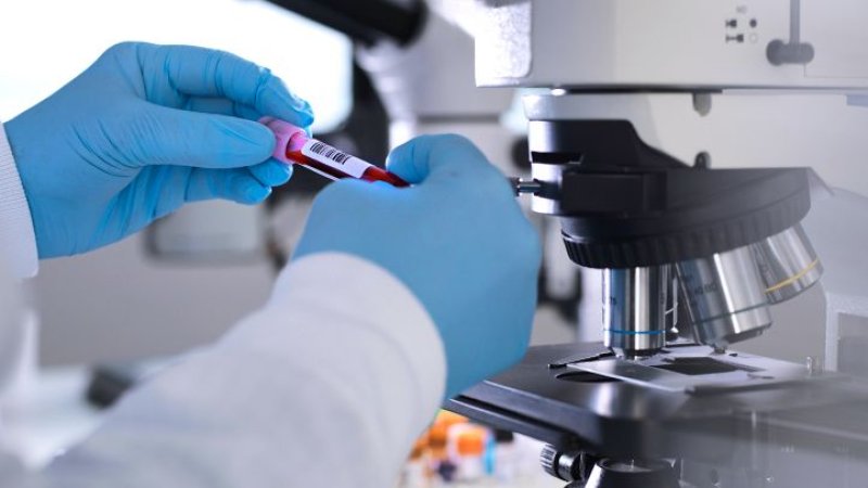 Scientists say they can cut HIV out of cells