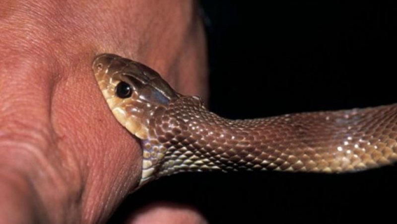 Student sits A/L exam despite snakebite in Point Pedro